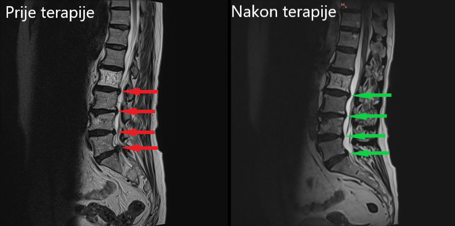 Fizikalna terapija - Marina Kovačević, mag. physioth